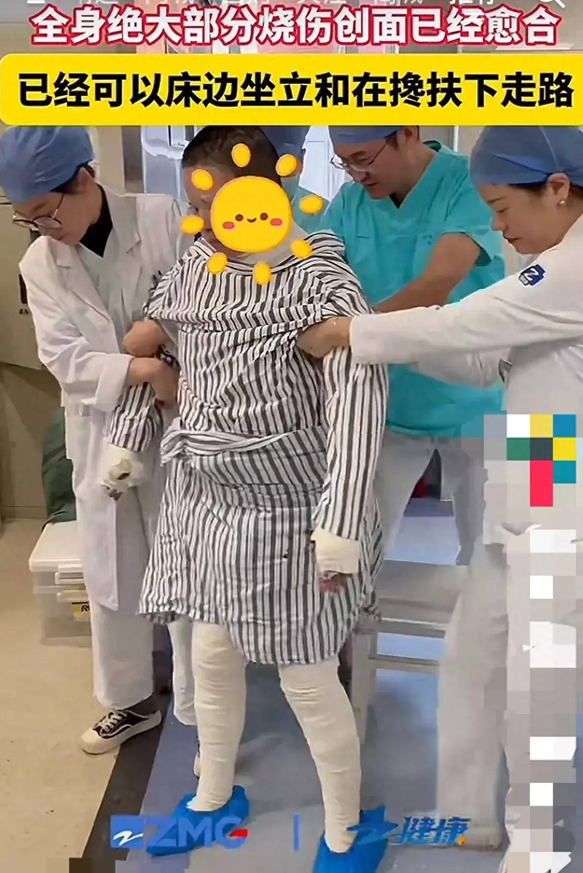 愈合能搀扶下地走路头发长出 1 寸凯发国际平台烧伤妈妈创面几乎全部